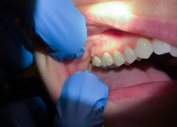 Best Pediatric Emergency Dentist in Flossmoor, IL