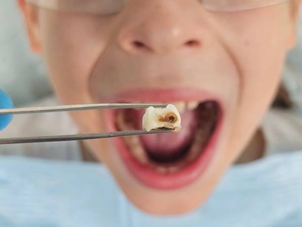 Best Walk-In Emergency Dentist in Flossmoor, IL